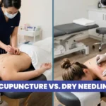 Acupuncture vs Dry Needling